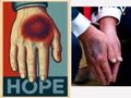Orange POS’ hand. “Hope”