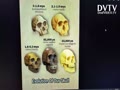 Evolution of our skull